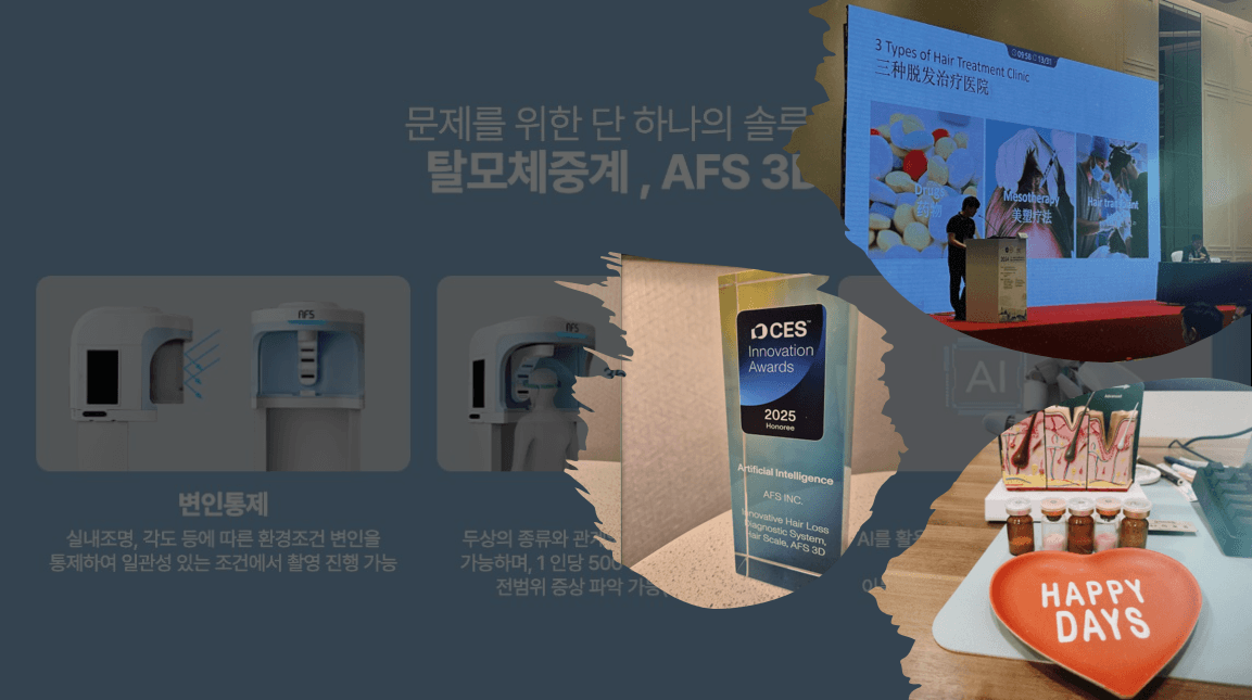 탈모치료전문병원 차이점 알아봅시다