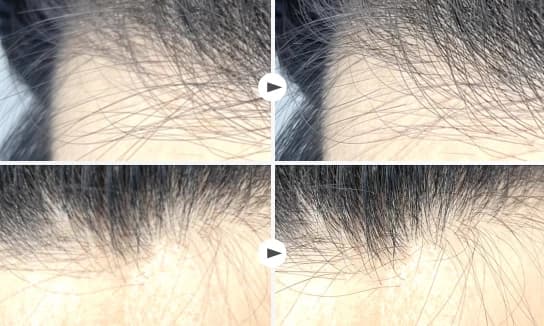 AFS 3D 경과 비교