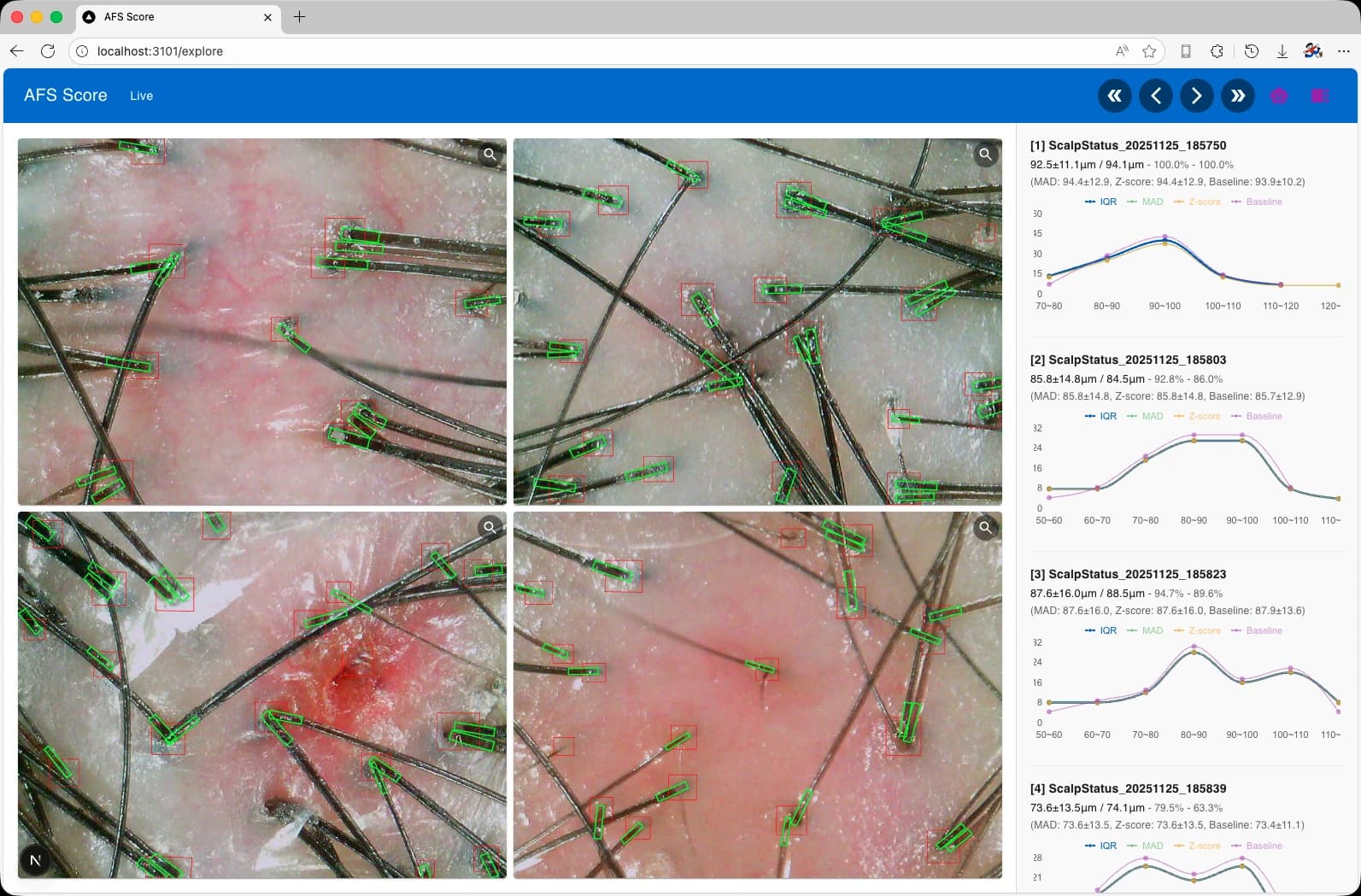 인공지능 기반 모낭 구분 점수