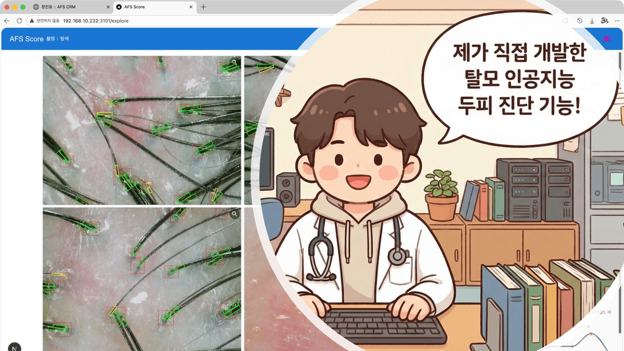탈모 인공지능 AFS Score 두피 진단 지원