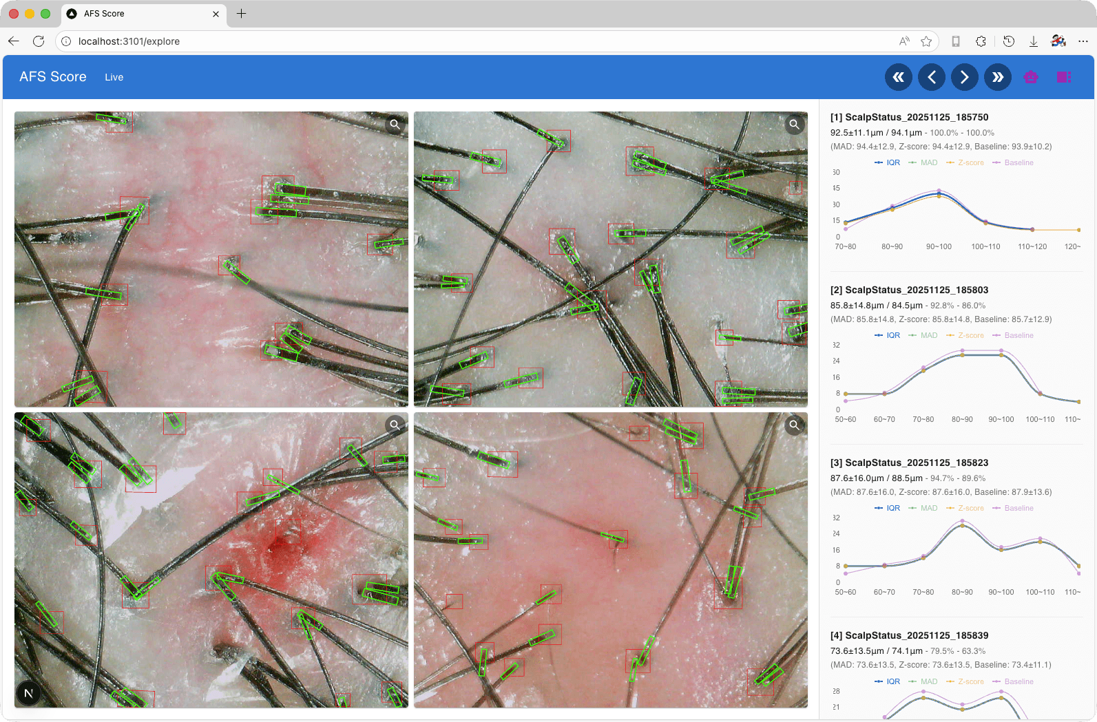 인공지능 기반 모낭 구분 점수