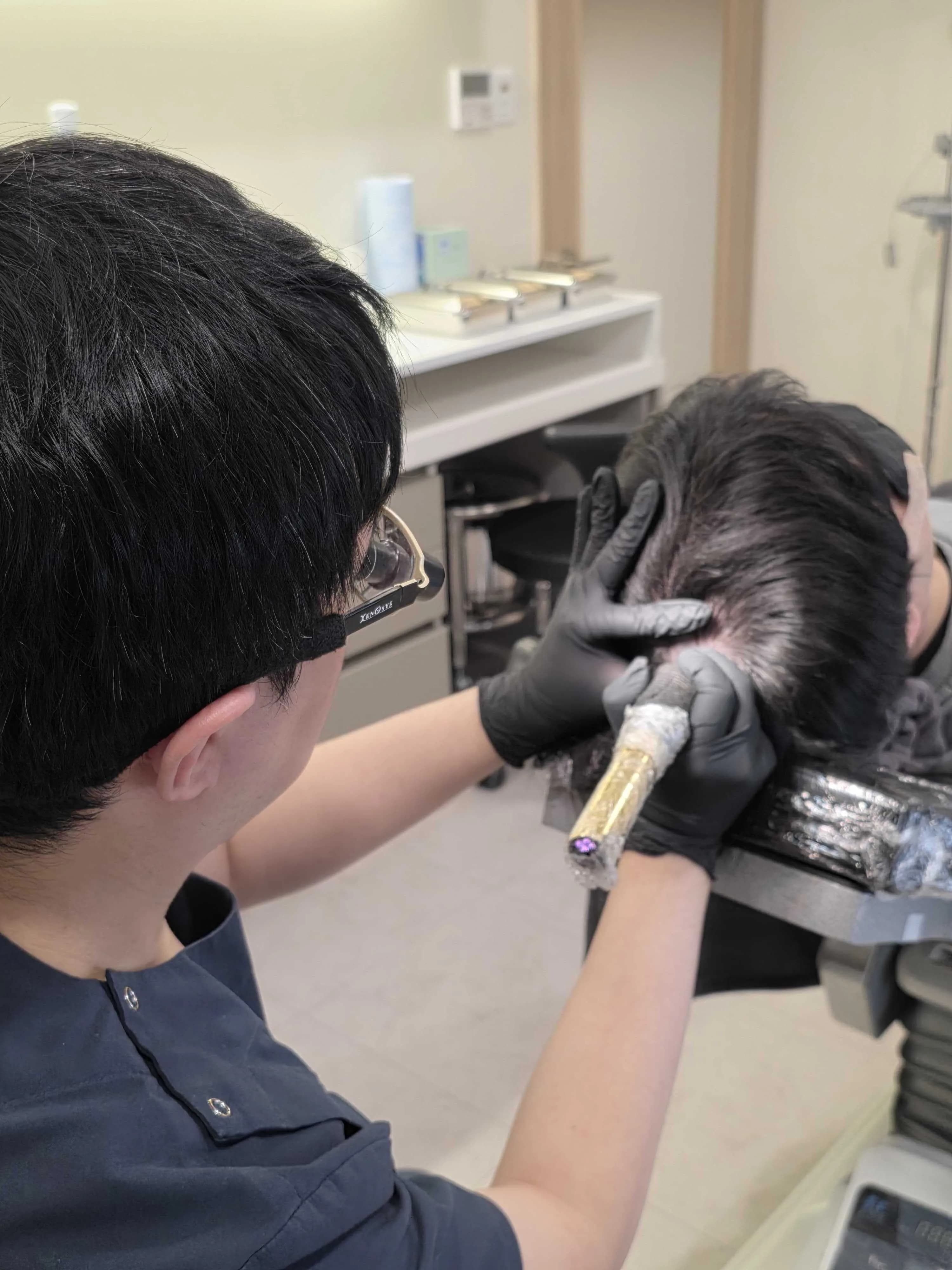 비어보이는 두피를 가리기 위한 두피문신